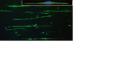 Astrocytes aligning on polymer nanofibres embedded in hydrogel, photo Divya Chari
